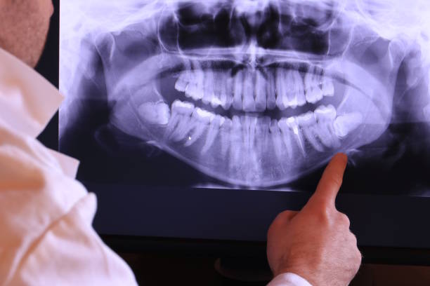 Best Emergency Root Canal Treatment in Middleborough Center, MA